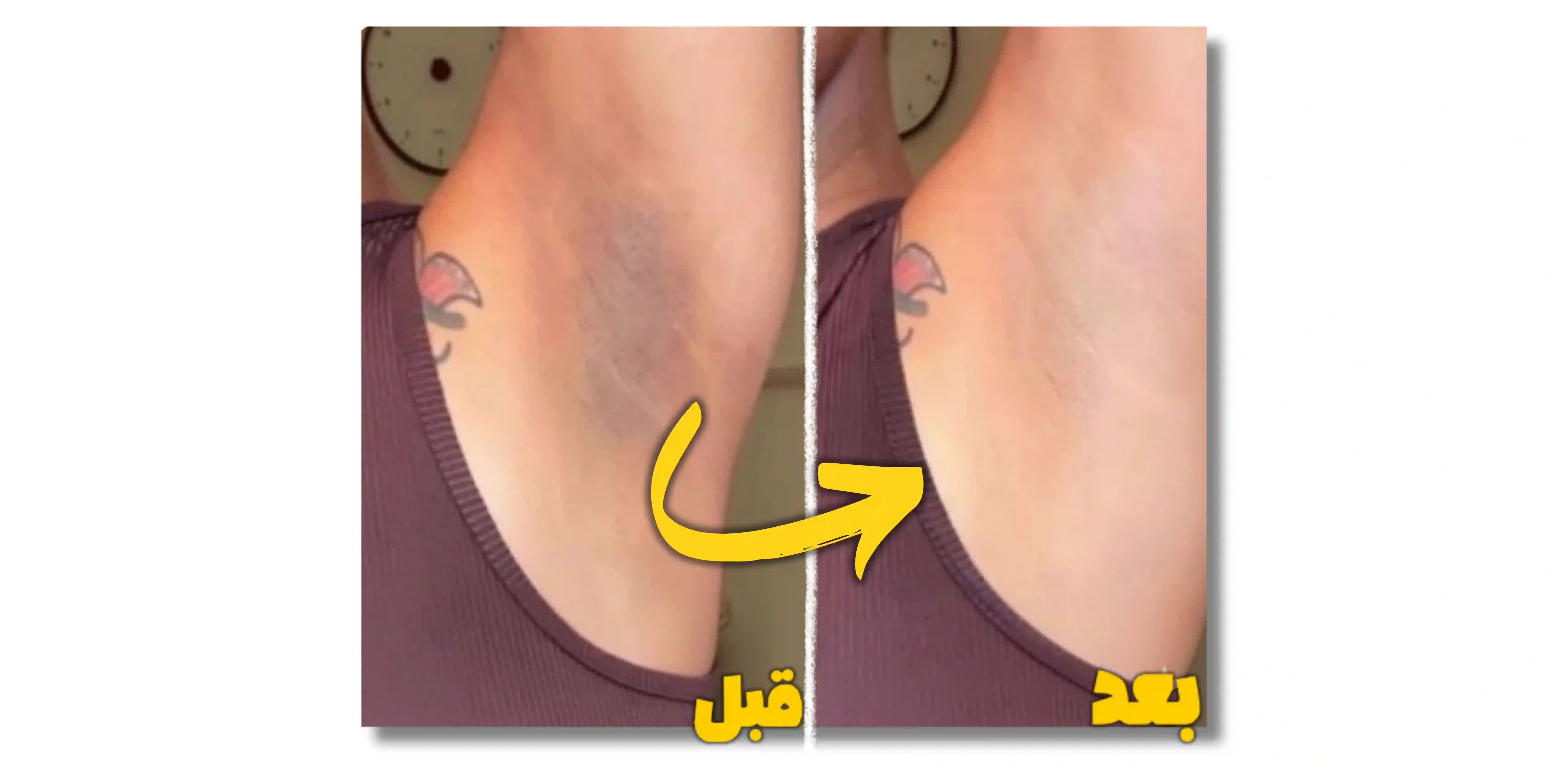 قبل و بعد از استفاده پکیج پاکسازی پوست میس گردو